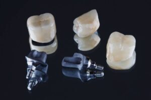 what are dental crowns