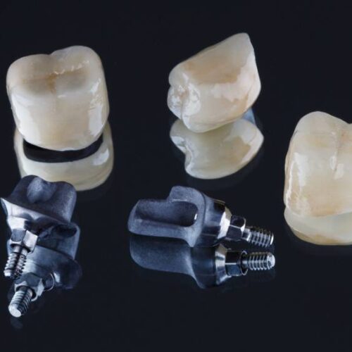 what are dental crowns