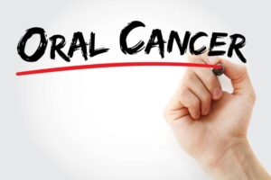oral cancer screening