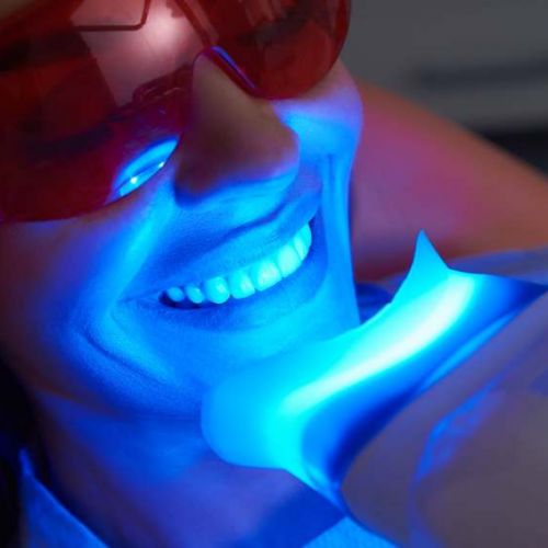 teeth whitening benefits