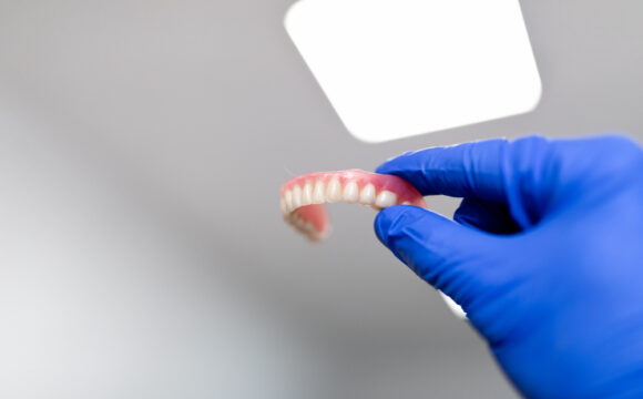 dental bridge vs implant