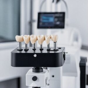 dental implants prices