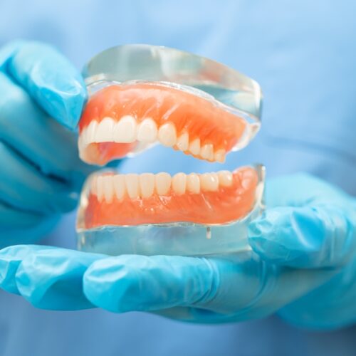 affordable dentures lawsuit
