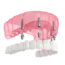 problems with snap-in dentures