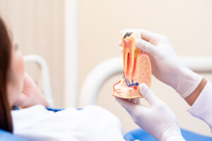 root canal before and after