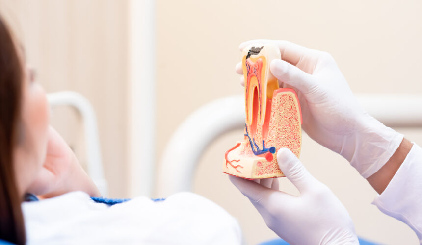 root canal before and after