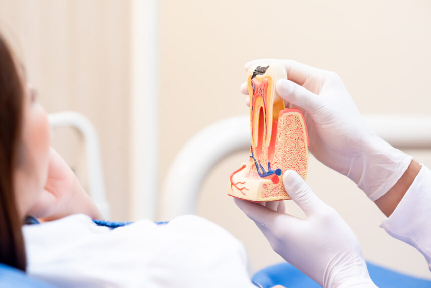 root canal before and after