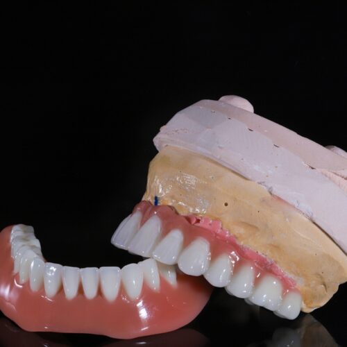 what is a hybrid denture