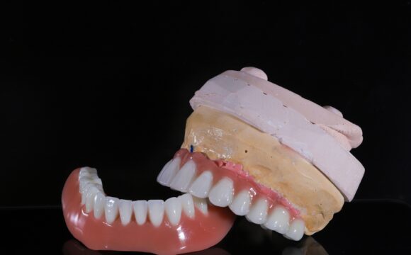 what is a hybrid denture
