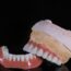what is a hybrid denture