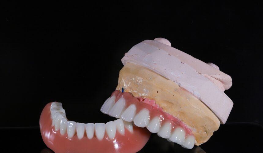 what is a hybrid denture